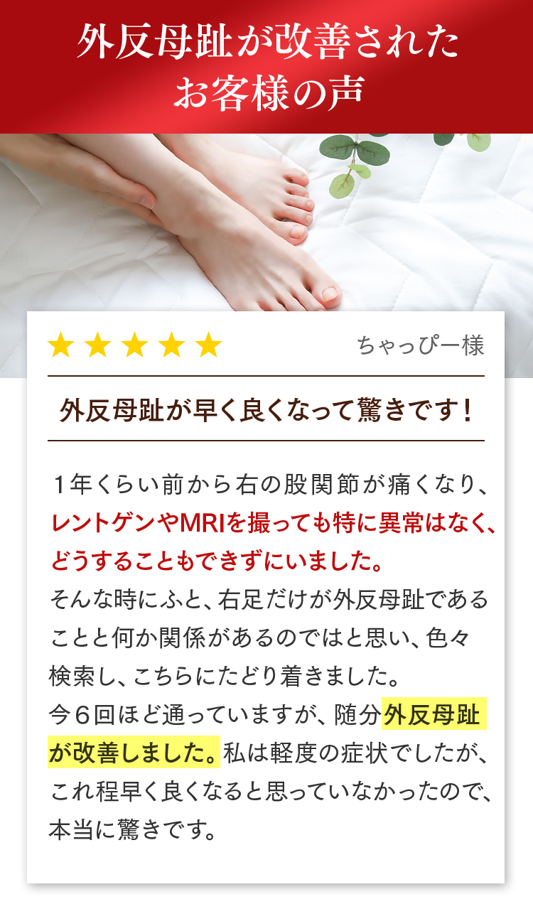 外反母趾
