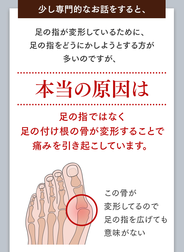 外反母趾