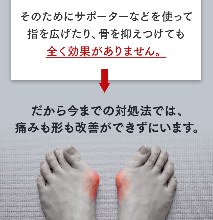 外反母趾