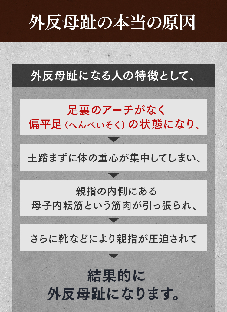 外反母趾