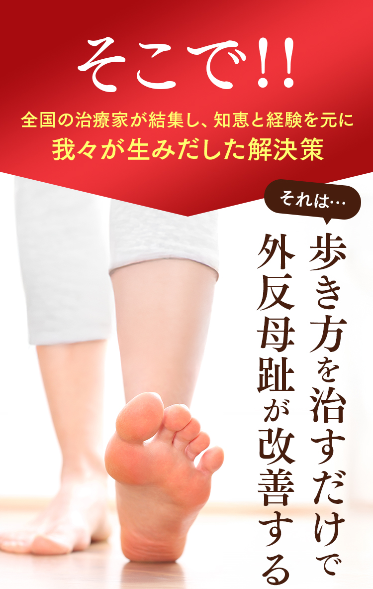 外反母趾