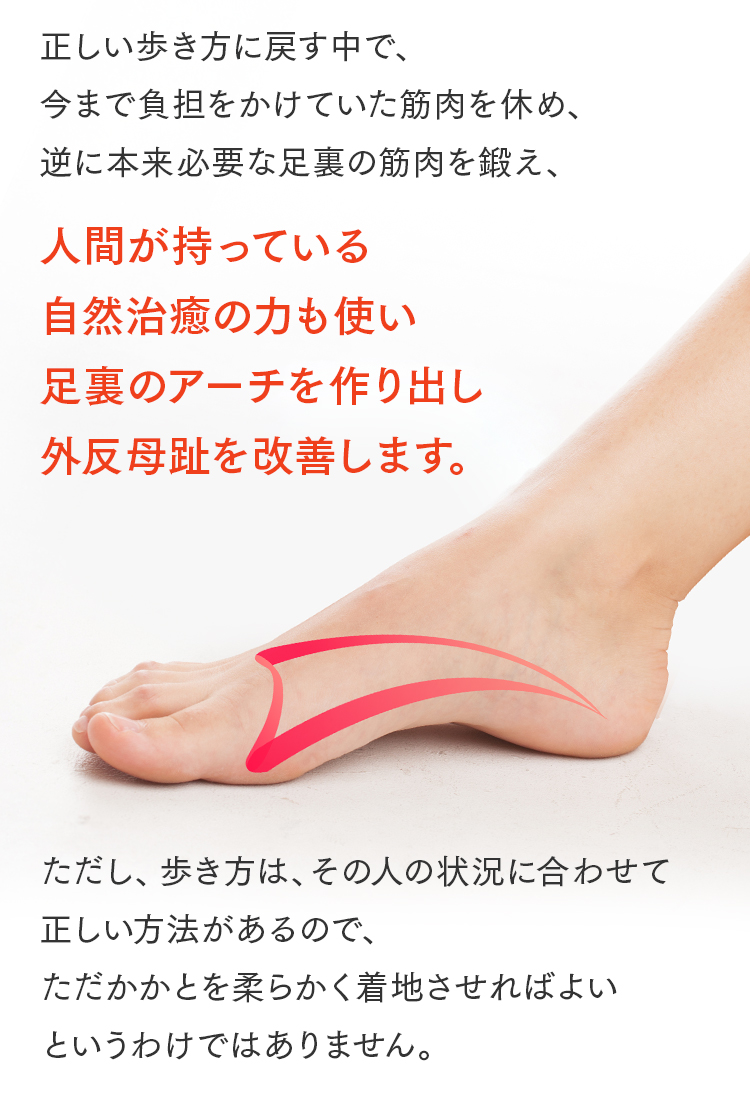 外反母趾