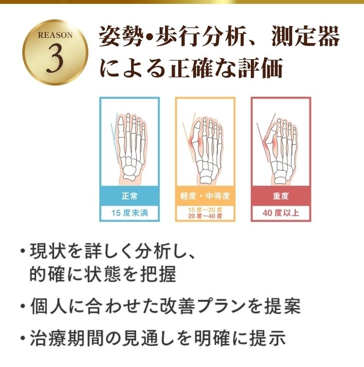 外反母趾